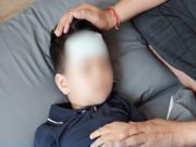 เด็ก 8 ขวบป่วย “บาดทะยัก”อาการหนัก หลังฉีดวัคซีนไม่ครบ