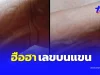 ฮือฮา เลขขึ้นบนแขน สาวฝันแปลกมีคนเอาแหวนทองมาสวมนิ้วให้