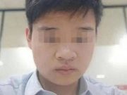 เคสช็อก! หนุ่มวัย 23 หลัง “ถอนฟัน” 2 ซี่ ต้องผ่าเปิดกะโหลก ดับสลดตั้งแต่อายุน้อย