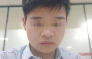 เคสช็อก! หนุ่มวัย 23 หลัง “ถอนฟัน” 2 ซี่ ต้องผ่าเปิดกะโหลก ดับสลดตั้งแต่อายุน้อย