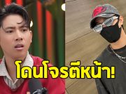 พระเอกดัง ขอบคุณโจรตีหน้า หลังได้หน้าใหม่หล่อกว่าเดิม