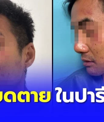 เกือบไม่รอด คนไทยในปารีส ถูกโจรปล้น ผลักล้ม-บีบคอจนหลอดลมอักเสบ