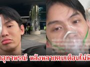 แฟนๆส่งกำลังให้ ดีเจมะตูม แชร์อุทาหรณ์จากความดื้อรั้น หลังหลายคนเตือนแล้วไม่ฟัง