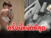 แฟนๆสุดห่วง นักแสดงหนุ่ม แชร์ภาพ นอน รพ.ครั้งนี้หนักสุดในชีวิต
