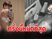 แฟนๆสุดห่วง นักแสดงหนุ่ม แชร์ภาพ นอน รพ.ครั้งนี้หนักสุดในชีวิต