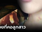 สะดุดตา “รอย” ที่คอลูกสาววัย 14 แม่ไม่จี้ถาม แต่พาไป “ช้อปปิ้ง” กลับมาบอกเลิกแฟนทันที