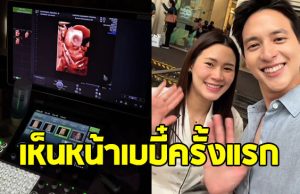 เจมส์ จิรายุ เปิดภาพอัลตร้าซาวด์ เห็นหน้าลูกครั้งแรก