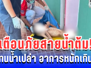 เตือนภัยสายดื่ม! น้ำต้มแทนน้ำเปล่า นานนับเดือน อาการหนักเกินคาด