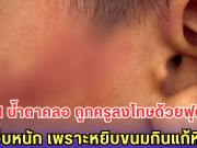 เด็กป.1 น้ำตาคลอ ถูกครูลงโทษด้วยฟุตเหล็ก เจ็บหนัก เพราะหยิบขนมกินแก้หิว