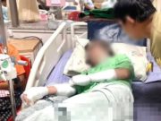 สะเทือนใจ สาวถูกลูกนายจ้างต้มน้ำร้อนราดหัว หลังรู้คบพี่ชาย