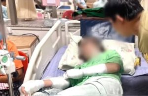 สะเทือนใจ สาวถูกลูกนายจ้างต้มน้ำร้อนราดหัว หลังรู้คบพี่ชาย