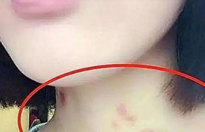 พ่อด่าเดือด ลูกสาววัย 15 บนคอมี “รอยช้ำสีแดง” เจอร่ายยาวโต้กลับ ปัญหาเกิดจากใคร?!
