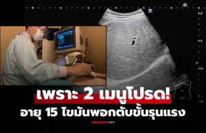 นร.อายุแค่ 15 ไขมันพอกจน “ตับขาวซีด” หมอบอกตรงๆ เพราะ 2 เมนูโปรด ที่ใครก็ชอบกิน!