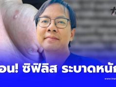 หมอเตือน “ซิฟิลิสระบาดหนัก” แล้ว ใครมีอาการดังนี้ ไปหาหมอด่วน