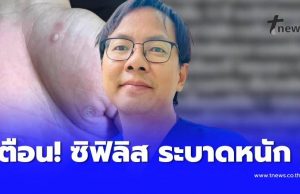 หมอเตือน “ซิฟิลิสระบาดหนัก” แล้ว ใครมีอาการดังนี้ ไปหาหมอด่วน