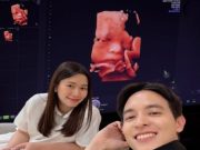 เจมส์ จิรายุ เผยภาพลูกชายในครรภ์ ดั้งโด่งหล่อแรงแซงคุณพ่อ