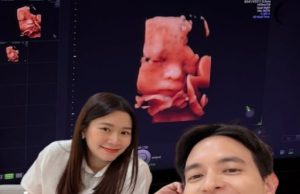 เจมส์ จิรายุ เผยภาพลูกชายในครรภ์ ดั้งโด่งหล่อแรงแซงคุณพ่อ