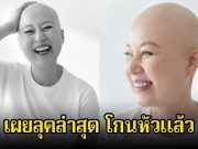 แฟนๆส่งกำลังใจ ตลกสาวชื่อดัง โกนหัวแล้ว หลังเพิ่งเข้ารับการรักษามะเร็ง
