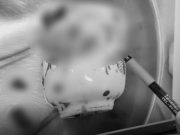 ช็อก! หนุ่มไต้หวันพบแก้วเซรามิกติดค้างในทวารหนัก อ้าง ‘เกิดขึ้นโดยอุบัติเหตุ’