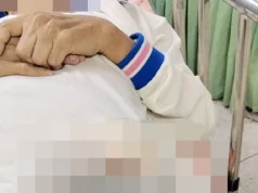 เรื่องใหญ่ ญาติร้องโรงพยาบาลตัดไหม คนไข้ 67 ปี ไส้ทะลักเสียชีวิต