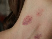 อวสานความฟิน แฟนหนุ่ม “จูบส่วนนี้” สาวอัมพาตเข้าห้องฉุกเฉิน หมอปวดหัว ทำกันแทบทุกคู่!