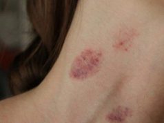 อวสานความฟิน แฟนหนุ่ม “จูบส่วนนี้” สาวอัมพาตเข้าห้องฉุกเฉิน หมอปวดหัว ทำกันแทบทุกคู่!