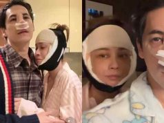 เอมี่ ศัลยกรรมย้อนวัยที่เกาหลี ซี แก้จมูกใหม่ใช้กระดูกซี่โครง เผยโฉมความสวยหล่อ