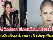 พิมพ์ พิมพ์มาดา เปิดภาพย้อนบทเรียนครั้งใหญ่ เคยป่วยเป็นมะเร็ง ครบ 10 ปี แฟนๆแห่ชื่นชม