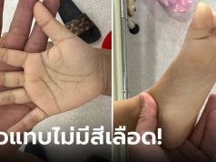 พ่อใจร่วง ลูกสาว 2 ขวบ ตัวซีดแทบไม่มีสีเลือด รีบอุ้มไปหาหมอ ทรุดสาเหตุ “นม” ที่ให้ดื่ม