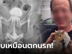 หนุ่มใหญ่กรีดร้อง “กระรอก” ติดอยู่ในก้น ข่วน-กัดภายในเลือดออก รู้ว่าเข้าไปได้ไงยิ่งอึ้ง!