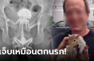 หนุ่มใหญ่กรีดร้อง “กระรอก” ติดอยู่ในก้น ข่วน-กัดภายในเลือดออก รู้ว่าเข้าไปได้ไงยิ่งอึ้ง!