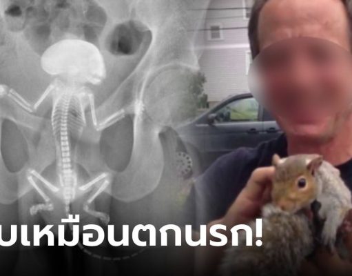 หนุ่มใหญ่กรีดร้อง “กระรอก” ติดอยู่ในก้น ข่วน-กัดภายในเลือดออก รู้ว่าเข้าไปได้ไงยิ่งอึ้ง!