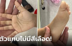 พ่อใจร่วง ลูกสาว 2 ขวบ ตัวซีดแทบไม่มีสีเลือด รีบอุ้มไปหาหมอ ทรุดสาเหตุ “นม” ที่ให้ดื่ม