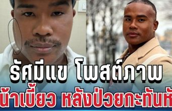 เกิดอะไรขึ้น! รัศมีแข โพสต์ภาพหน้าเบี้ยว หลังป่วยกะทันหัน หมอเผยสาเหตุชัด