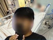 สรุปดราม่าศัลยกรรมคลินิกดัง 4.8 แสน เข้า ICU ค่ารักษาพุ่ง 2 ล้าน