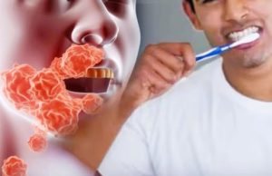 สังเกตง่ายๆ แปรงฟันเห็นสิ่งนี้ หมอเตือน “มะเร็ง” มาเคาะประตู รู้ตัวไวอาจไม่เป็นหายนะ