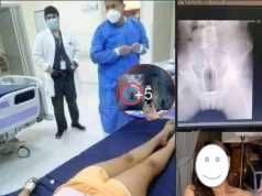 อึงทั้ง โรงบาล ” สาวพาตัวเองขึ้นสวรรค์ ” ขาดตัวช่วยจากหนุ่มๆ เลยยัดสิ่งนี้เข้าไปแทน ผลคือ..หมอถึงกับ