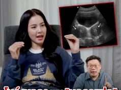 รู้จัก ภาวะ “มดลูกแฝด” ของ “โบว์ เมลดา” บางคนอาจมี แต่ไม่รู้ตัว