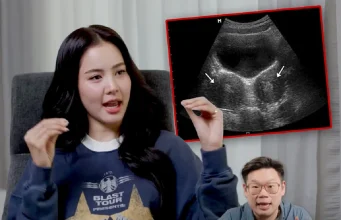 รู้จัก ภาวะ “มดลูกแฝด” ของ “โบว์ เมลดา” บางคนอาจมี แต่ไม่รู้ตัว