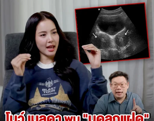 รู้จัก ภาวะ “มดลูกแฝด” ของ “โบว์ เมลดา” บางคนอาจมี แต่ไม่รู้ตัว