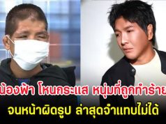 โอ้โห น้องฟ้า โหนกระแส หนุ่มที่ถูกนายจ้างทำร้ายจนหน้าผิดรูป ล่าสุดจำแทบไม่ได้
