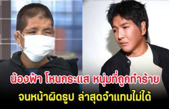 โอ้โห น้องฟ้า โหนกระแส หนุ่มที่ถูกนายจ้างทำร้ายจนหน้าผิดรูป ล่าสุดจำแทบไม่ได้