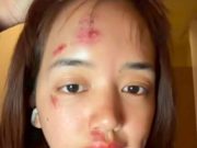 เห็นแล้วตกใจ พลอย พิกกะพลอย เผยสาเหตุหน้าเยิน หลังล่องเรือใน ตปท.