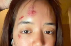 เห็นแล้วตกใจ พลอย พิกกะพลอย เผยสาเหตุหน้าเยิน หลังล่องเรือใน ตปท.