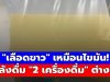 ช็อก! ชายวัย 29 เลือดเป็นสีขาวข้น เหมือน “ไขมัน” หลังดื่ม “2 เครื่องดื่มนี้” ต่างน้ำ 6 เดือน หวิดดับ