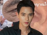 “เจมส์ จิรายุ” เจอเตือนตรงๆ หมอฝากเช็ก 3 อาการ หลังคอเลสเตอรอลพุ่ง