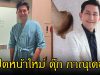 เปิดหน้าใหม่ ดุ๊ก ภาณุเดช หลังไปเสริมหล่อมา คนแห่ทักหน้าเด็กลง 10 ปี