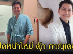เปิดหน้าใหม่ ดุ๊ก ภาณุเดช หลังไปเสริมหล่อมา คนแห่ทักหน้าเด็กลง 10 ปี