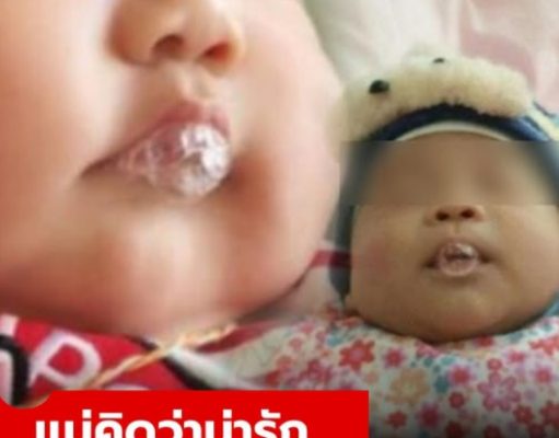 ลูกน้อย 2 เดือน ชอบเล่นน้ำลาย “เป็นฟองสบู่” แม่คิดว่าน่ารัก แต่แพทย์สั่งแอดมิทด่วน!