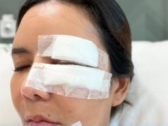 อุทาหรณ์ สาวให้อาหารหมาจร สุดท้ายโดนฝากเขี้ยวเย็บหน้า 50 เข็ม